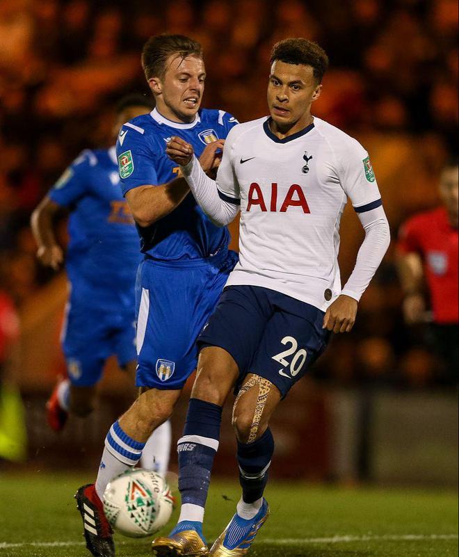 柏林联合多克希： 专门练过跑位进球 最难对付的是凯恩（柏林联合多克希：专练跑位抢点，凯恩最难对付）